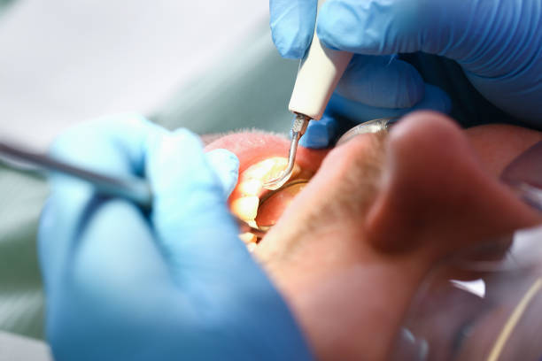 Tooth Infection Emergency Dentist in AZ